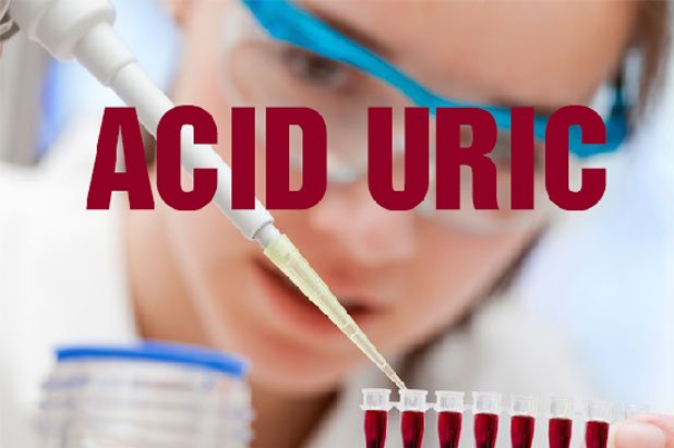 xét nghiệm acid uric máu